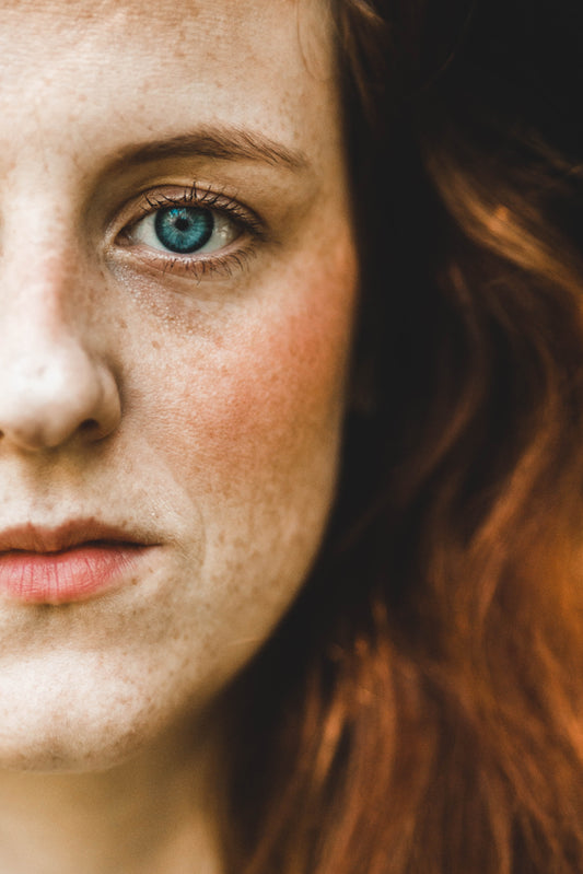 Dermatologist Explains - Are they Dark Spots or Melasma?
