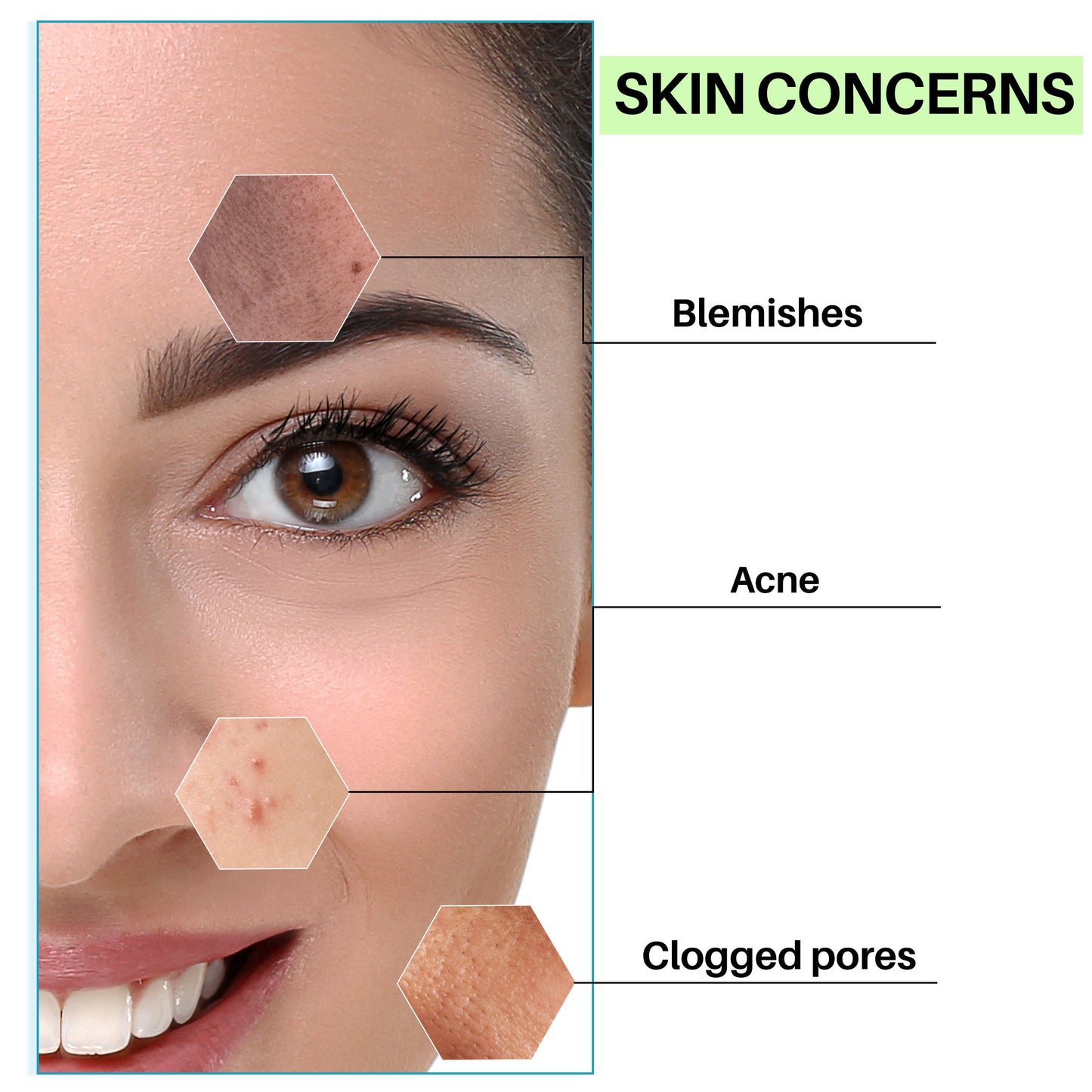 dermdoc-blemish-clearing-face-toner-with-salicylic-acid-and-milk-protein-100-ml-3