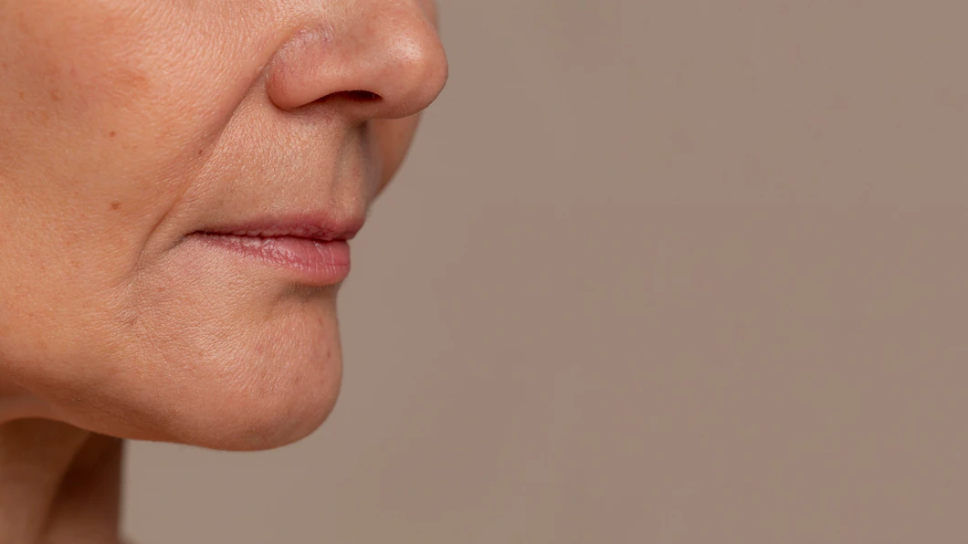 Retinoid Rash Retinoids and retinol to boost your skin health: All that you need to ...
