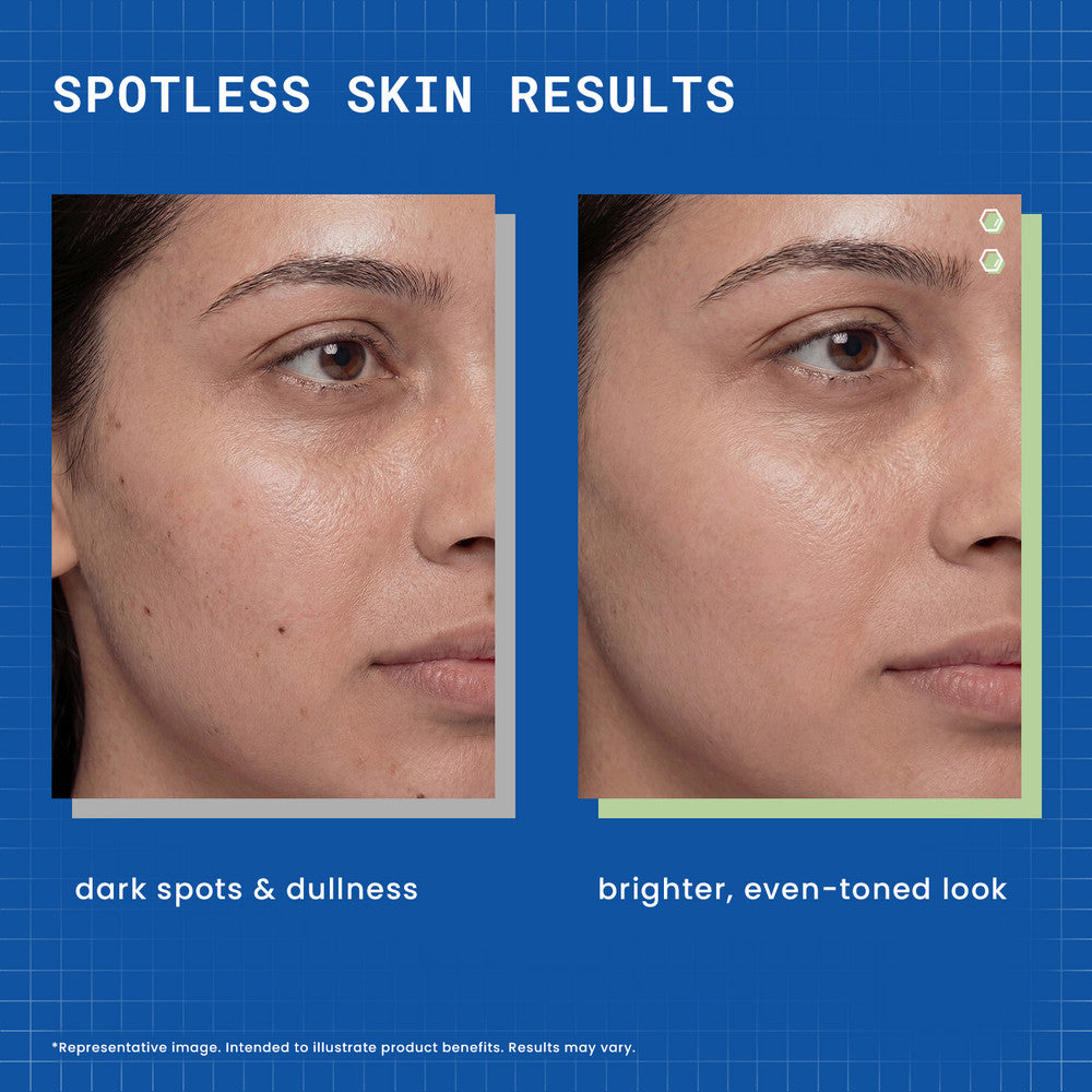 DermDoc 2% Kojic Acid Face Serum