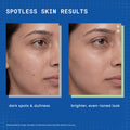 DermDoc 2% Kojic Acid Face Serum
