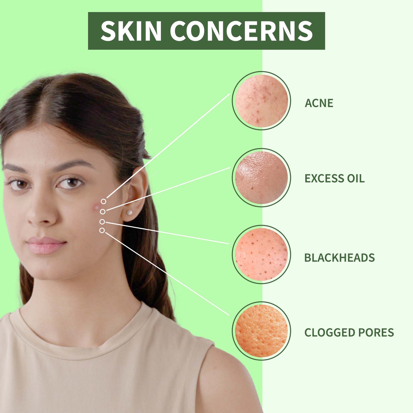 DermDoc Anti Acne Facial Kit with Salicylic Acid For Clear & Acne Free Skin (34 g)